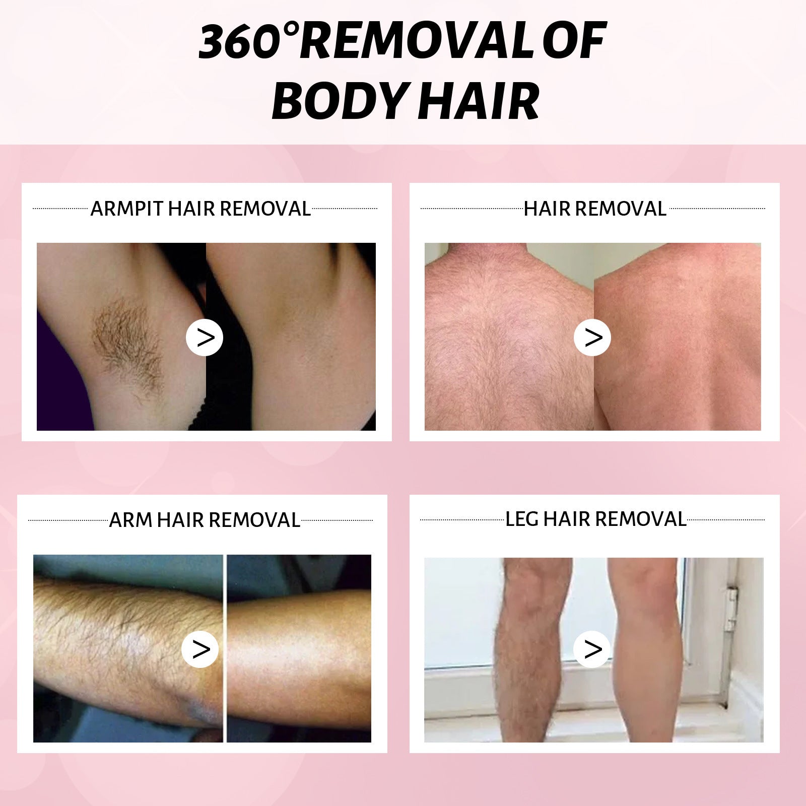 30ml & 100ml Hair Removal Spray